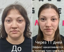 Топовые процедуры для твоей красоты!